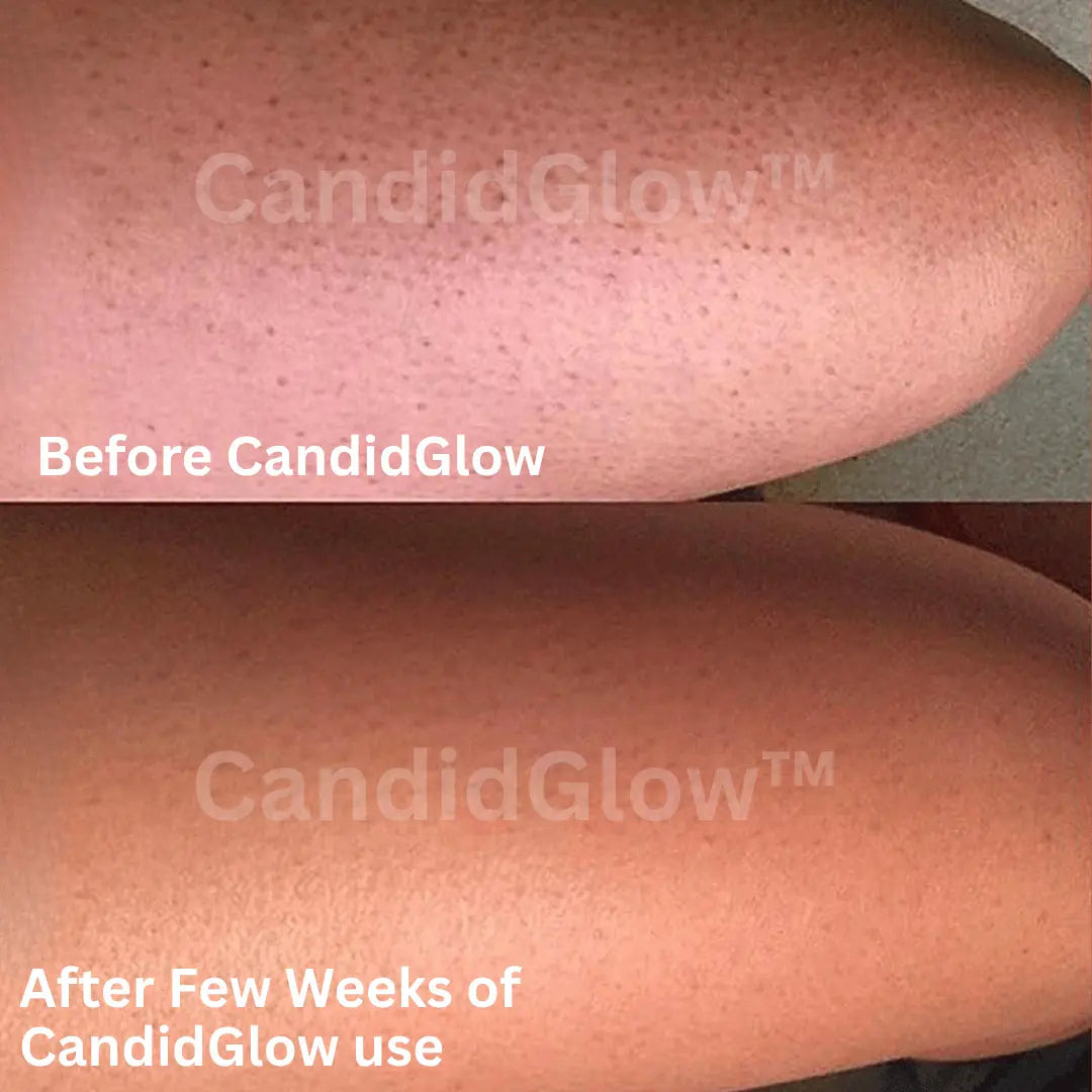 3PCS | CandidGlow™ Premium Exfoliating Body Mitt Glove