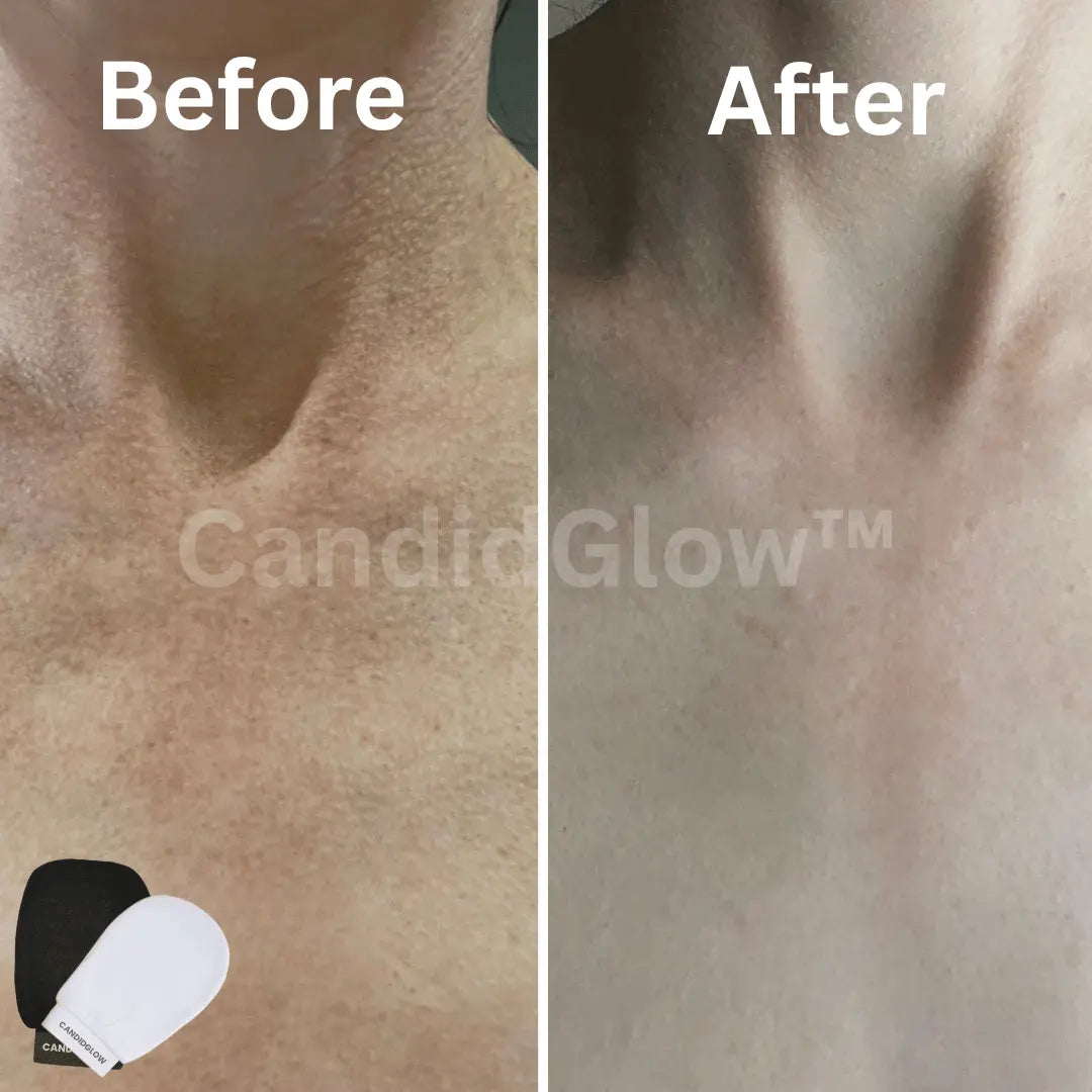 3PCS | CandidGlow™ Premium Exfoliating Body Mitt Glove
