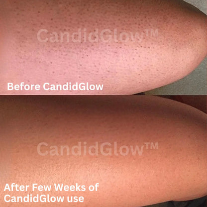 3PCS | CandidGlow™ Premium Exfoliating Body Mitt Glove