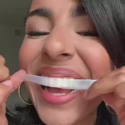 CandidBright™ Professional Teeth Whitening (14 Strips)